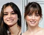Ana De Armas' Plastic Surgery Journey