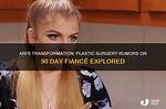 Ari from 90 Day Fiancs Plastic Surgery Rumours Explored Mon 25 October 2021 11:03 Helen |