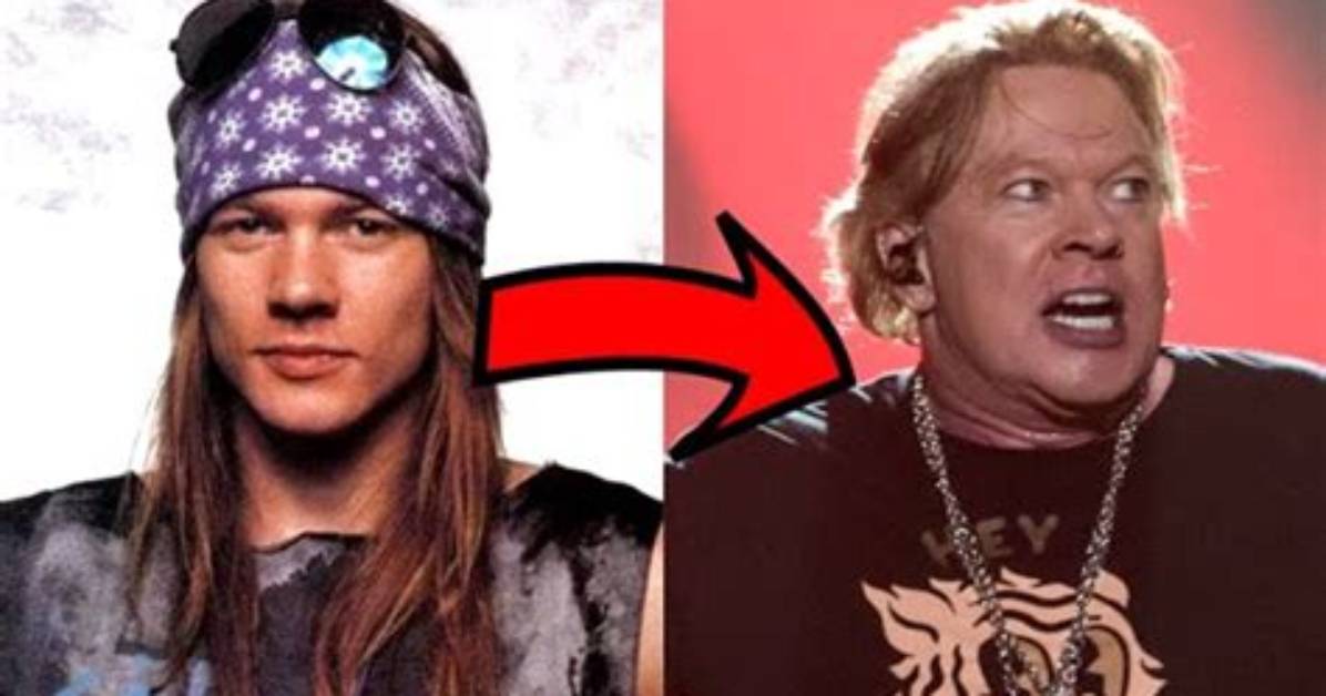Axel Rose Now: the Evolution of a Rock Legend