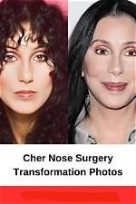 Cher's Plastic Surgery: How She Hasn't Aged a Day Since the 60S