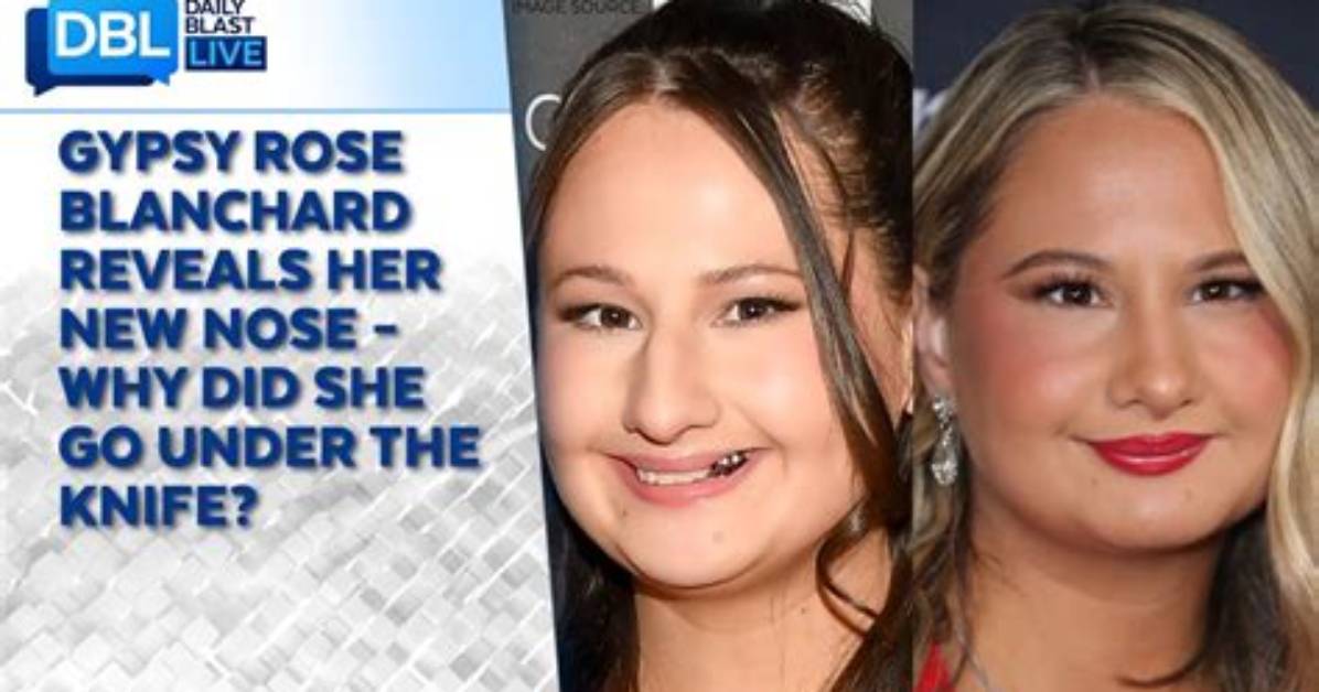 Did Gypsy Rose Get New Teeth? the Transformation Journey