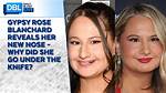 Did Gypsy Rose Get New Teeth? the Transformation Journey