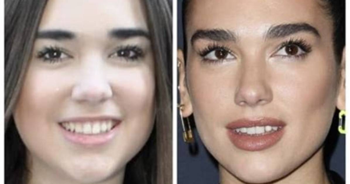 Did She Underwent Surgery? |