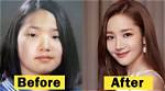 Did Yeonmi Park Had a Plastic Surgery? Is She Fake? Husband, Son and Instagram |