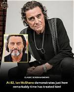Does Ian Mcshane Have a Glass Eye? Actor Eye Related Injury and Condition Described |