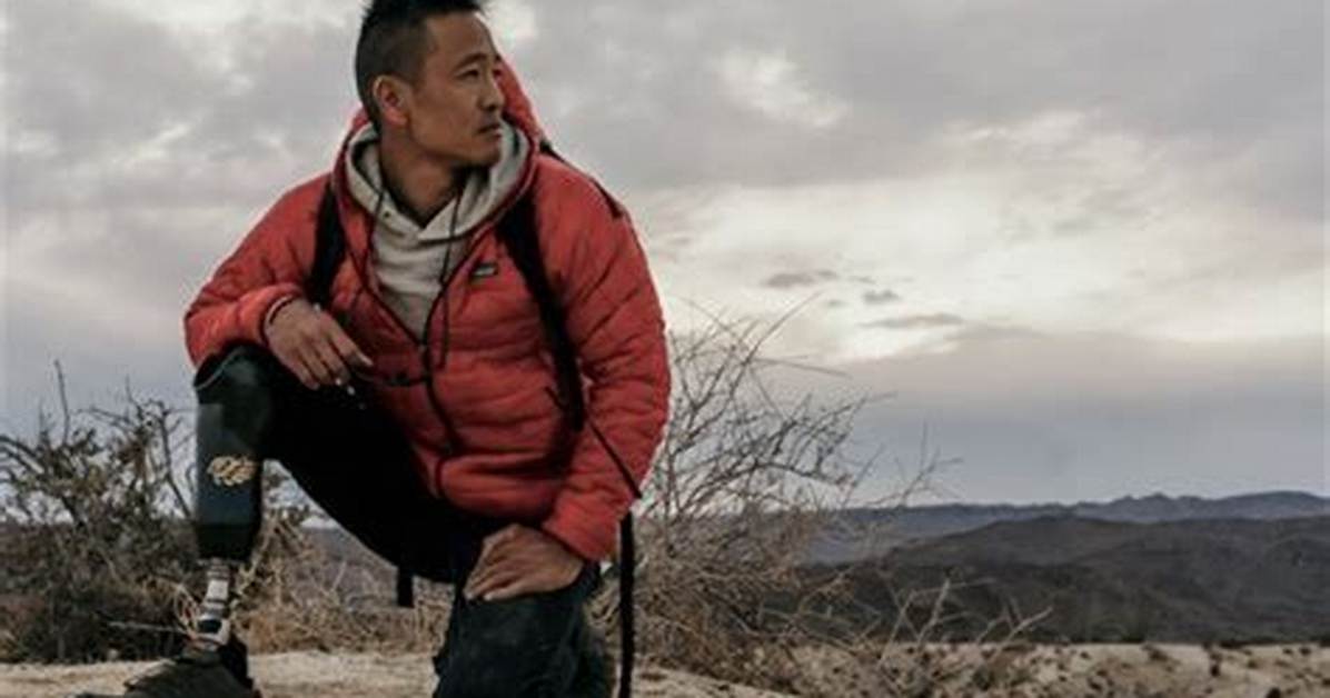 Dr Albert Lin Wikipedia Biography What Happened to His Leg? |