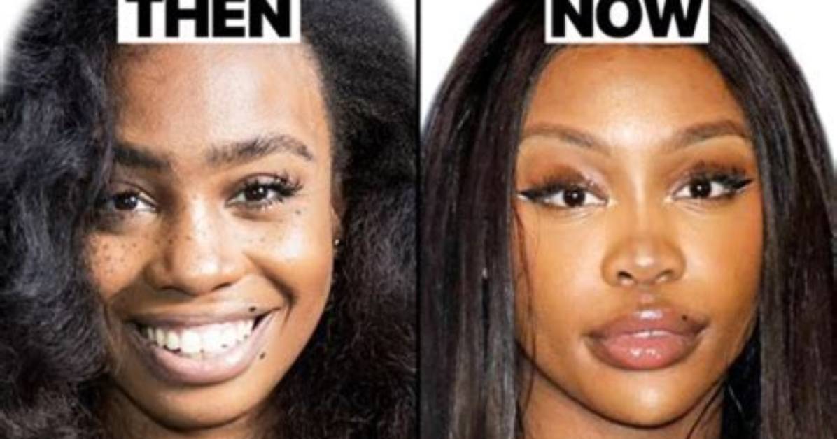 Exploring the Truth: Has Tyla Had Plastic Surgery?