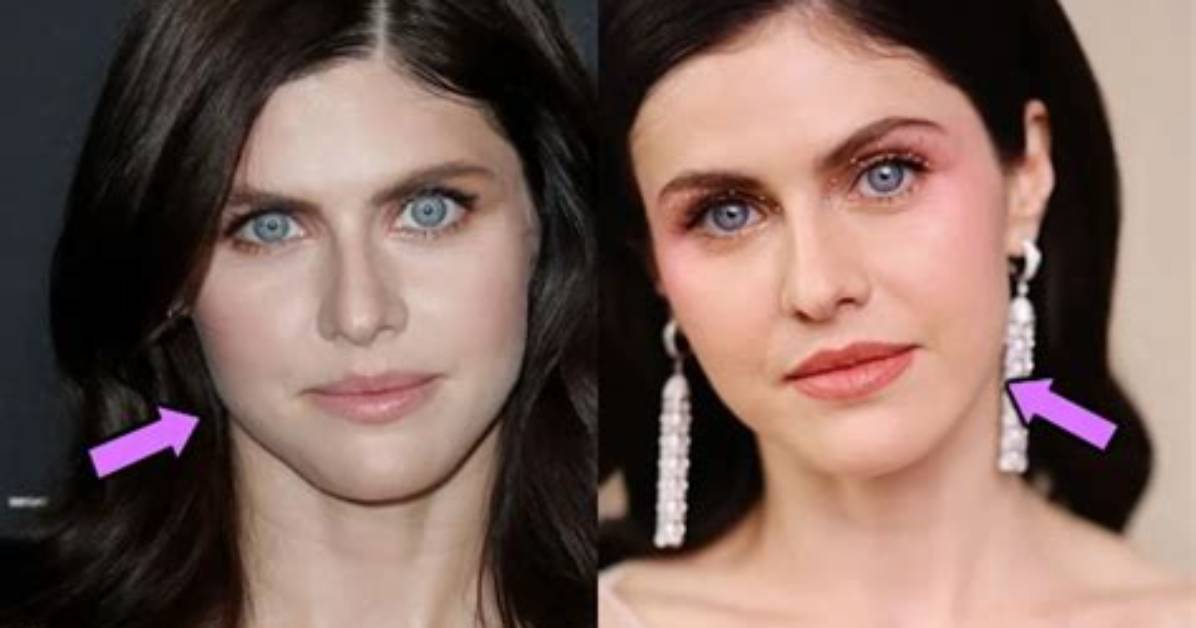 Has Alexandra Rose Had Plastic Surgery on Chin? Before and After Photos on Ig