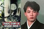 Hisashi Ouchi: the Tragic Story of a Radiation Accident Victim