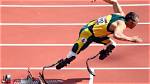 How Did Ray Barnett Lose His Legs on Er? Here’ What Happened Exactly ·