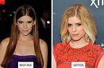 Kate Mara Nose Surgery: Before and After Photo