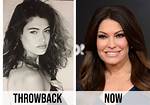 Kimberly Guilfoyle Plastic Surgery