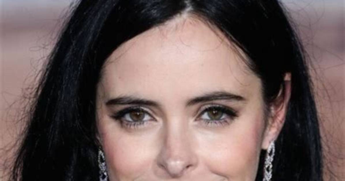 Krysten Ritter | Plastic Surgery Botox and Nose Job Before and After Photo