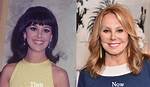 Marlo Thomas's Plastic Surgery Journey