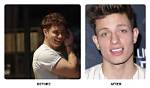 Matt Rife's Teeth Transformation: Before and After