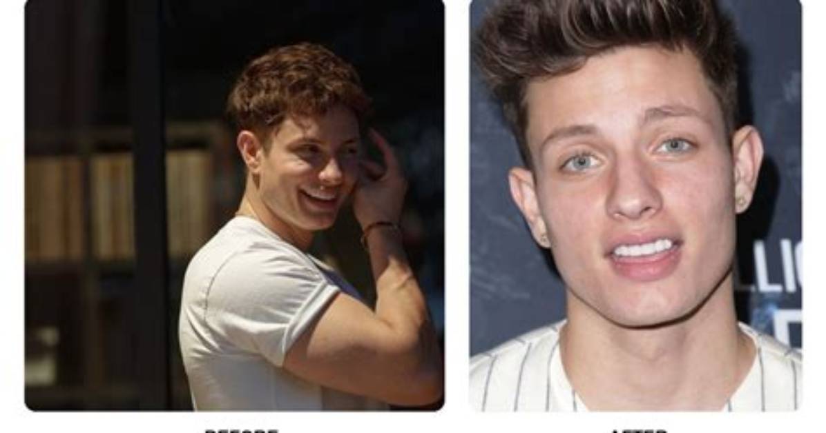 Matt Rife Teeth