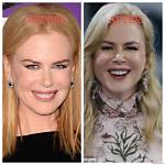 Nicole Kidman's Plastic Surgery: Unveiling the Transformation