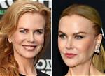 Nicole Kidman: the Truth Behind Her Surgeries