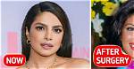 Sherlyn Chopra's Plastic Surgery Journey: Before and After