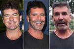 Simon Cowell's New Face: a Transformation to Remember