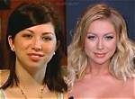 Stassi Breast Reduction: Before and After Revelations
