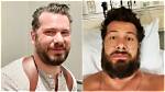 Steven Crowder Plastic Surgery: Separating Fact from Fiction