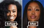 Sza's Strength and Resilience Before Surgery