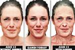 Tanning Bed Before and After 1 Week: Uncover the Surprising Revelations