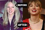 Taylor Swift's "Is It over Now?" Lyrics & Harry Styles Connection, Explained |
