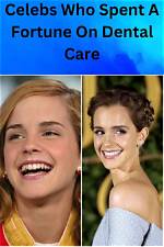 The Surprising Truth About Celebrities' Secret Dental Struggles