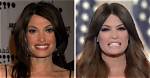 Transformations Unveiled: the Journey of Kimberly Guilfoyle Before and After
