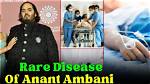 Unraveling the Mystery: Which Disease Anant Ambani Has?