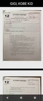 Unveiling Insights into the "Gigi Bryant Autopsy Sketch"