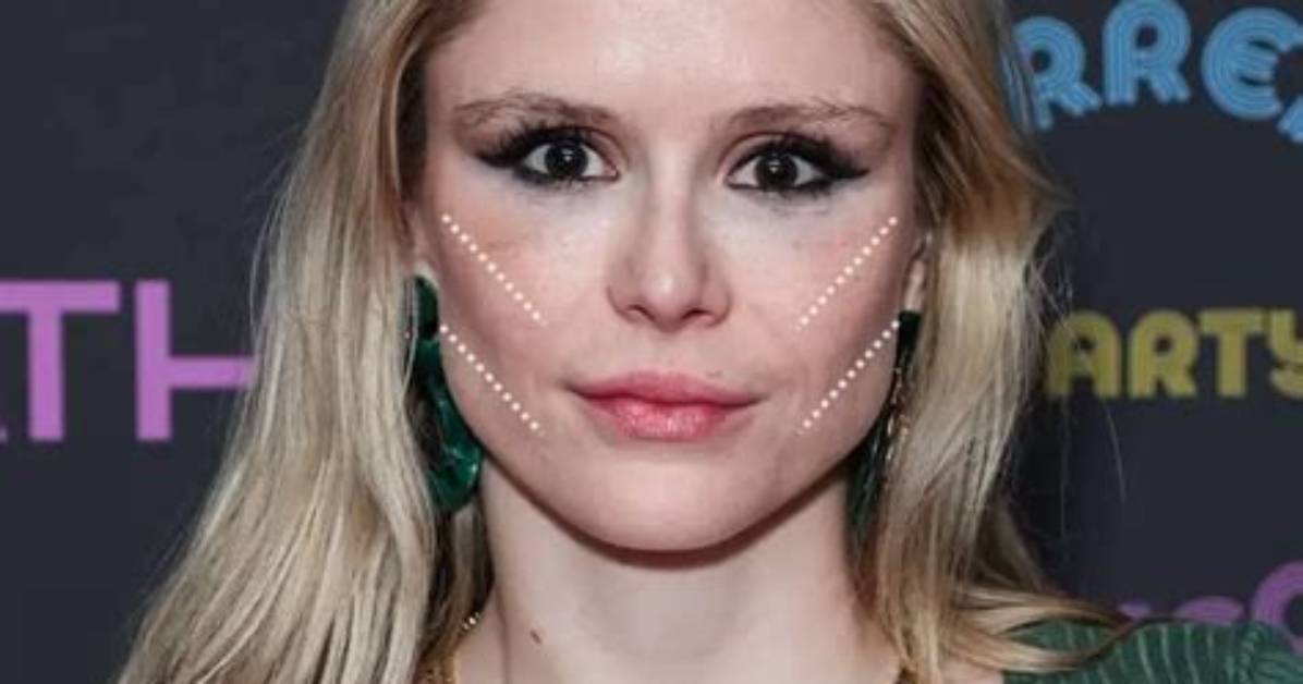Unveiling the Secrets of Erin Moriarty's Buccal Fat Removal Transformation