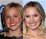 Unveiling the Secrets of "Kristen Bell Nose": Discoveries and Insights