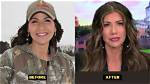 Unveiling the Transformation: Keisti Noem Plastic Surgery Journey