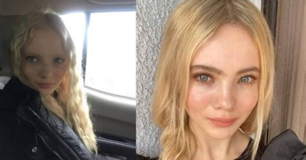 Vlogjam | Photos: Has Freya Allan Had Plastic Surgery