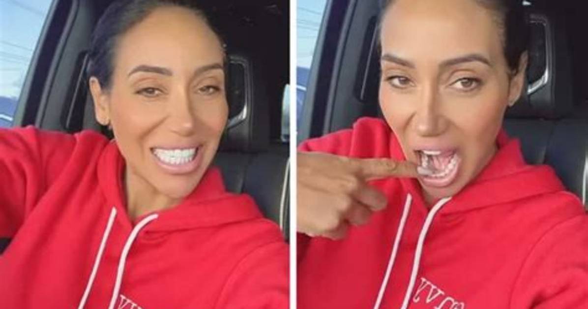 What Teeth Whitener Does Melissa Gorga Use? Celebrity. Fm #1 Official Stars, Business & Peopl